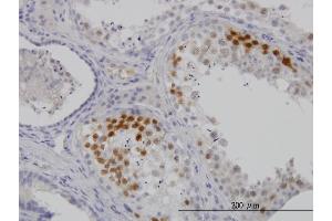 Immunoperoxidase of monoclonal antibody to CDK3 on formalin-fixed paraffin-embedded human testis.