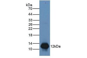 Figure. (S100A8 anticorps  (AA 1-93))