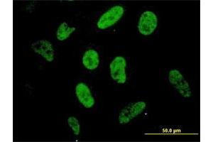 Immunofluorescence of monoclonal antibody to SP1 on HeLa cell.