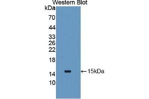 Detection of Recombinant GLUT14, Human using Polyclonal Antibody to Glucose Transporter 14 (GLUT14)