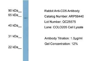 WB Suggested Anti-CD5  Antibody Titration: 0.