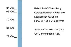 WB Suggested Anti-CD5  Antibody Titration: 0. (CD5 anticorps  (N-Term))