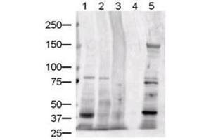 Image no. 3 for anti-Jagged 1 (JAG1) (AA 110-125) antibody (ABIN226630) (JAG1 anticorps  (AA 110-125))