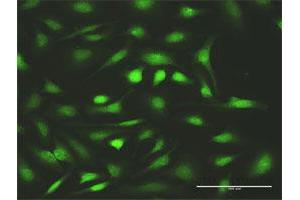 Immunofluorescence of purified MaxPab antibody to FANCC on HeLa cell.