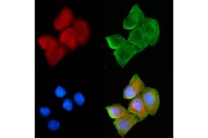 ABIN6265052 and ABIN6272430 staining Hela cells(30 min of UV treatment) by IF/ICC. (SH3BGR anticorps  (Internal Region))