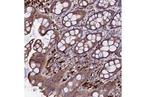 Immunohistochemical staining of human rectum with RLTPR polyclonal antibody  shows moderate cytoplasmic positivity in glandular cells at 1:50-1:200 dilution.