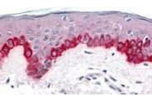 Immunohistochemistry of Apaf1 in human skin tissue with Apaf1 (CT) antibody at 20 μg/ml. (APAF1 anticorps  (C-Term))
