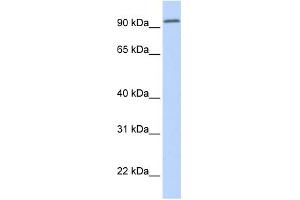 WB Suggested Anti-DPP6 Antibody Titration:  0. (DPP6 anticorps  (Middle Region))