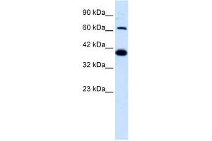 WB Suggested Anti-GRIK2 Antibody Titration:  1. (GRIK2 anticorps  (N-Term))
