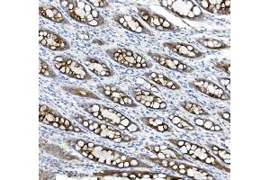 IHC analysis of MUC5B using anti-MUC5B antibody (ABIN7602056).