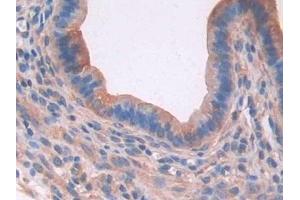 Detection of PON2 in Mouse Uterus Tissue using Polyclonal Antibody to Paraoxonase 2 (PON2)