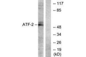 Western blot analysis of extracts from LOVO cells, using ATF2 (Ab-73 or 55) Antibody. (ATF2 anticorps  (AA 40-89))