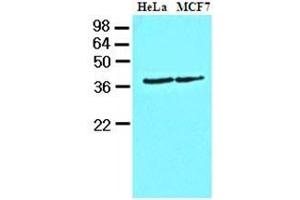Cell lysates of HeLa and MCF7 (40 ug) were resolved by SDS-PAGE, transferred to nitrocellulose membrane and probed with anti-human Casein Kinase 1 alpha (1:1000). (CSNK1A1 anticorps  (AA 1-337))