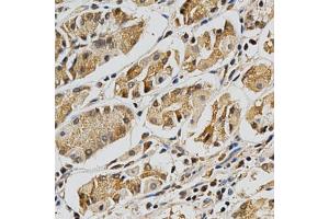 Immunohistochemistry of paraffin-embedded human stomach using LGALS3 Antibody (ABIN5970683) at dilution of 1/200 (40x lens). (Galectin 3 anticorps)
