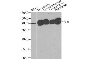 Western blot analysis of extracts of various cell lines, using ALB antibody. (Albumin anticorps)