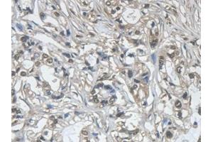 anti-Galectin 7 (LGALS7) (AA 1-136) antibody