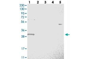 Western blot analysis of Lane 1: RT-4, Lane 2: U-251 MG, Lane 3: Human Plasma, Lane 4: Liver, Lane 5: Tonsil with WBSCR27 polyclonal antibody  at 1:250-1:500 dilution.