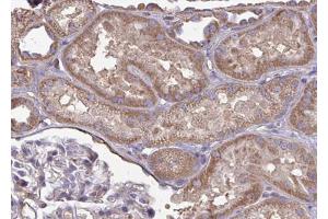 ABIN6266972 at 1/100 staining human kidney tissue sections by IHC-P.