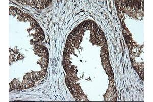 Image no. 3 for anti-Musashi Homolog 2 (MSI2) antibody (ABIN1499578)