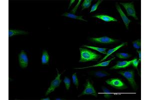 Immunofluorescence of purified MaxPab antibody to CAST on HeLa cell.
