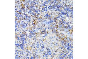 Immunohistochemistry of paraffin-embedded mouse spleen using CAD antibody (ABIN6130029, ABIN6137837, ABIN6137838 and ABIN6224367) at dilution of 1:100 (40x lens). (CAD anticorps  (AA 1650-1900))