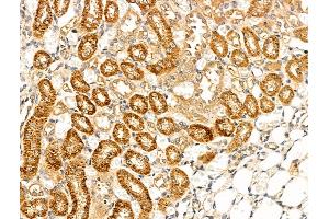 ABIN7094821 and ABIN7098872 at 1/100 staining Rat kidney tissue by IHC-P.
