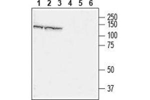 Western blot analysis of rat brain (lanes 1 and 4), mouse brain (lanes 2 and 5) and mouse C2C12 muscle myoblast cell line (lanes 3 and 6) lysates: - 1-3. (CHERP anticorps  (Cytosolic))