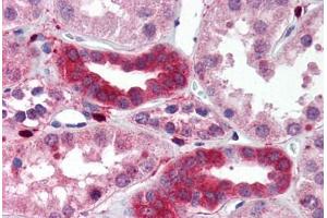Human Kidney (formalin-fixed, paraffin-embedded) stained with MAP3K7IP1 antibody ABIN214510 at 2. (TAB1 anticorps)