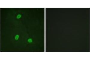 Immunofluorescence analysis of HeLa cells, using NIPA (Ab-354) Antibody. (ZC3HC1 anticorps  (AA 320-369))