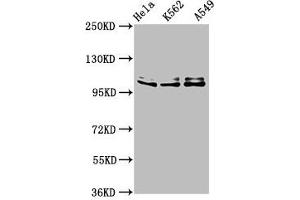 Western Blot Positive WB detected in: Hela whole cell lysate, K562 whole cell lysate, A549 whole cell lysate All lanes: XAB2 antibody at 3 μg/mL Secondary Goat polyclonal to rabbit IgG at 1/50000 dilution Predicted band size: 101 kDa Observed band size: 101 kDa (XAB2 anticorps  (AA 750-840))