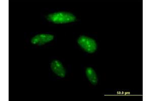 Immunofluorescence of purified MaxPab antibody to BAZ2B on HeLa cell. (BAZ2B anticorps  (AA 1-643))