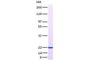 Validation with Western Blot