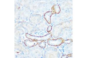 Immunohistochemistry of paraffin-embedded mouse kidney using NDUFV1 Rabbit pAb  at dilution of 1:100 (40x lens). (NDUFV1 anticorps  (AA 1-250))