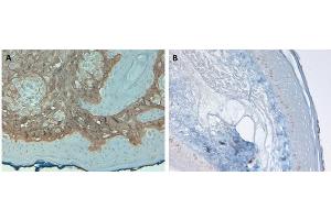 Immunohistochemistry of Rabbit Anti-Collagen Type I Antibody.