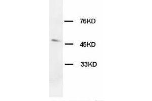 Image no. 2 for anti-Hypocretin (Orexin) Receptor 1 (HCRTR1) (C-Term) antibody (ABIN1492942)