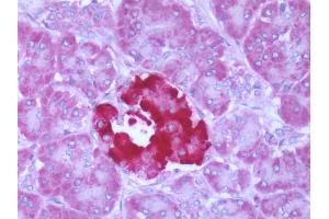 Human Pancreas: Formalin-Fixed, Paraffin-Embedded (FFPE) (FFAR1 anticorps  (Cytoplasmic Domain))