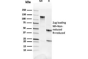 SDS-PAGE Analysis Purified Fodrin Mouse Monoclonal Antibody (SPTAN1/3352). (SPTAN1 anticorps  (AA 2351-2475))