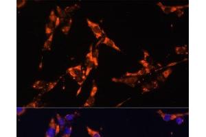 Immunofluorescence analysis of HeLa cells using IL18 Polyclonal Antibody at dilution of 1:100. (IL-18 anticorps)