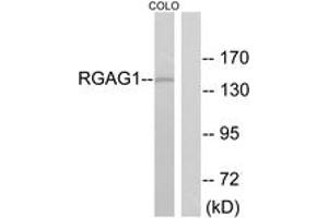 Western blot analysis of extracts from COLO cells, using RGAG1 Antibody. (RGAG1 anticorps  (AA 1331-1380))