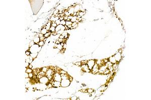 Immunohistochemistry of paraffin-embedded human liver using [KO Validated] Cytokeratin 8 Rabbit pAb (ABIN3021287, ABIN3021288, ABIN3021289, ABIN1513142 and ABIN1514287) at dilution of 1:50 (40x lens). (KRT8 anticorps  (AA 1-483))