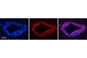 Rabbit Anti-ESD Antibody Catalog Number: ARP58619_P050 Formalin Fixed Paraffin Embedded Tissue: Human Heart Tissue Observed Staining: Cytoplasm in endothelial and smooth muscle cells in arterioles Primary Antibody Concentration: 1:100 Other Working Concentrations: 1:600 Secondary Antibody: Donkey anti-Rabbit-Cy3 Secondary Antibody Concentration: 1:200 Magnification: 20X Exposure Time: 0.