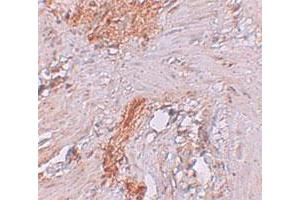 Immunohistochemical staining of human colon cells with RBM35A polyclonal antibody  at 2. (ESRP1 anticorps  (N-Term))
