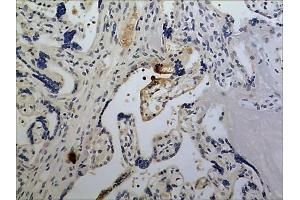 Immunohistochemistry (IHC) image for anti-Chemokine (C-X-C Motif) Ligand 1 (Melanoma Growth Stimulating Activity, Alpha) (CXCL1) (AA 35-107) antibody (ABIN1983118)