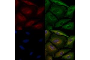 ABIN6260917 and ABIN6278560 staining  cells by IF/ICC. (CNR2 anticorps  (C-Term))