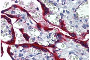 Human Placenta: Formalin-Fixed, Paraffin-Embedded (FFPE)