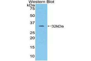Western Blotting (WB) image for anti-Janus Kinase 1 (JAK1) (AA 596-841) antibody (ABIN3205083) (JAK1 anticorps  (AA 596-841))
