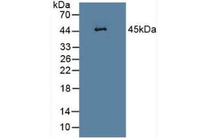 Detection of LEI in Rat Heart Tissue using Polyclonal Antibody to Leukocyte Elastase Inhibitor (LEI)