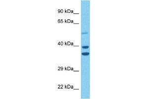 Host:  Rabbit  Target Name:  LDHB  Sample Tissue:  Human 293T Whole Cell  Antibody Dilution:  1ug/ml