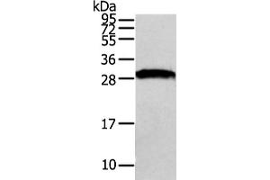 Western Blotting (WB) image for anti-VAMP (Vesicle-Associated Membrane Protein)-Associated Protein A, 33kDa (VAPA) antibody (ABIN5962090) (VAPA anticorps)
