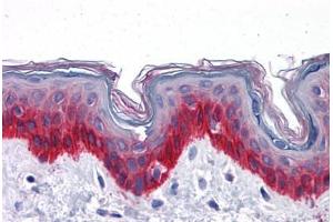 Human Skin: Formalin-Fixed, Paraffin-Embedded (FFPE) (KRT81 anticorps  (AA 1-203))